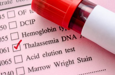 Alt= hasil lab anak dengan thalasemia