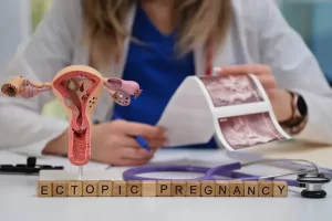 Kehamilan Ektopik: Kenali Gejala dan Pentingnya Penanganan Dini