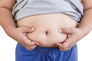 Waspada Obesitas pada Anak: 5 Tips Menjaga Berat Badan Ideal